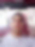 صورة العضو